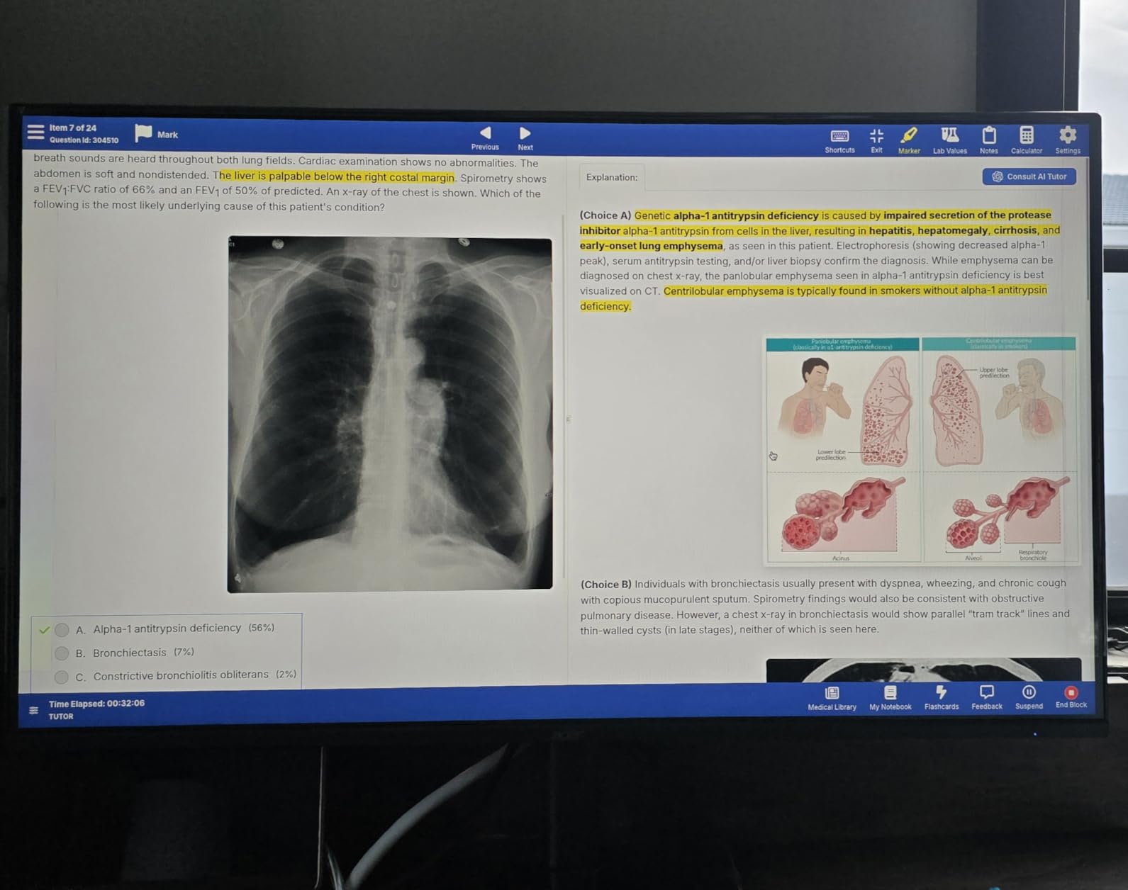 Acer KB242Y - 23.8 Inch IPS Zero-Frame Full HD (1920 x 1080) Monitor | Tilt | Up to 120Hz Refresh | 1ms (VRB) | sRGB 99% | HDMI & VGA Ports | Adaptive-Sync Support (FreeSync Compatible) customer photo 2