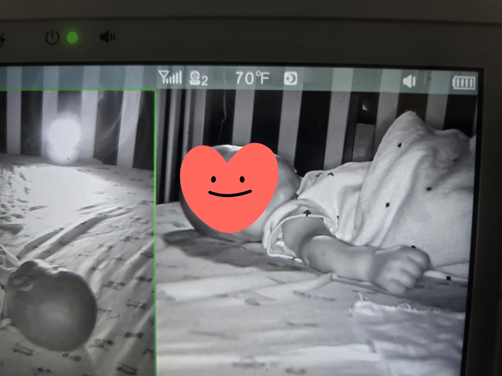 Babysense 5