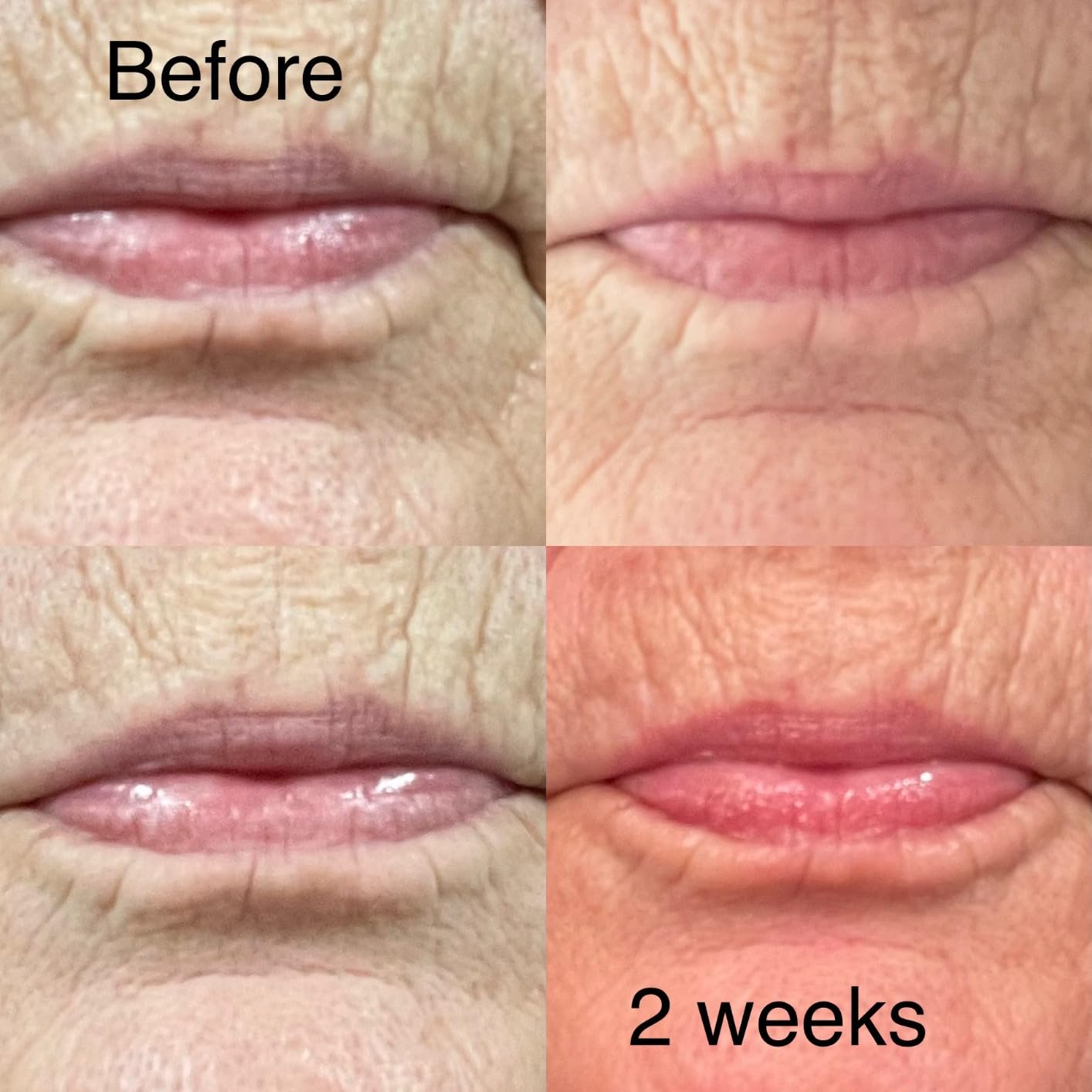 DRx SpectraLite LipWare Pro LED Device | Red Light Mask for Visibly Plumping & Volumizing Lips - FDA Cleared customer photo 1