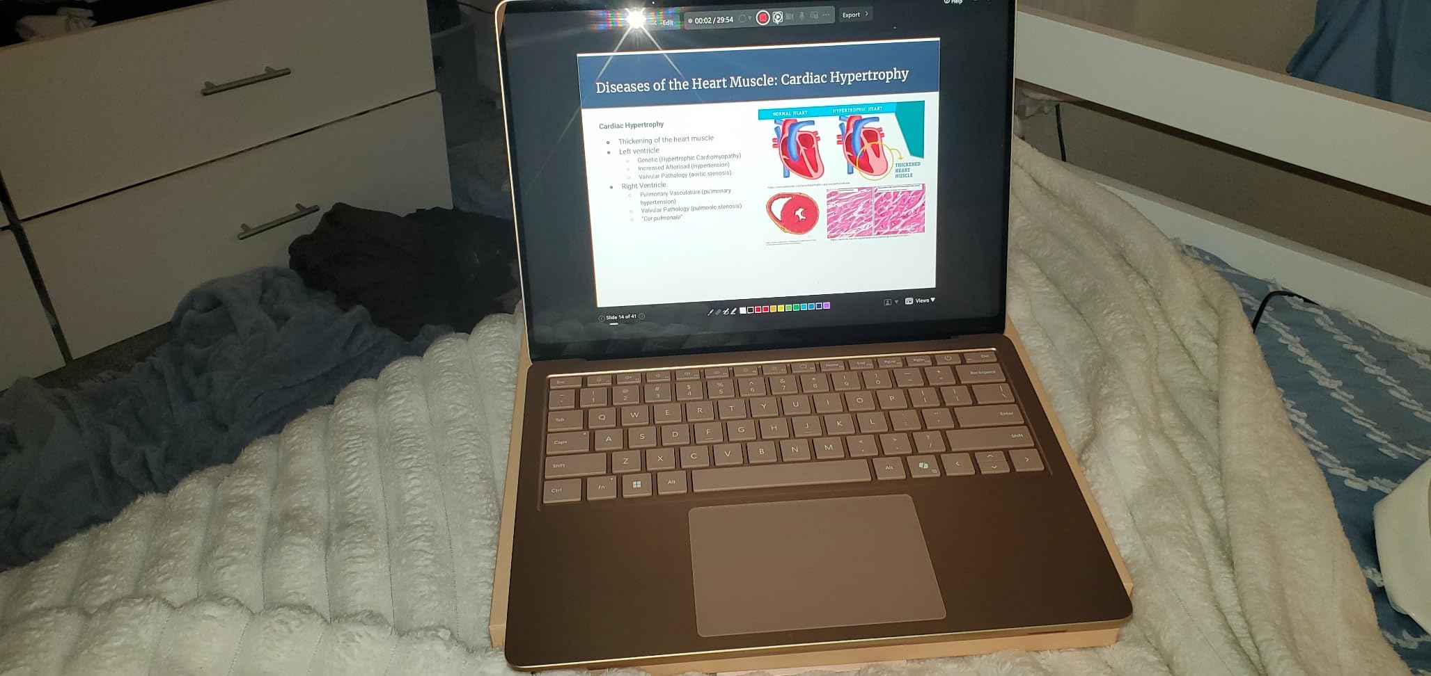 Surface Laptop (2024), Windows 11 Copilot+ PC, 13.8