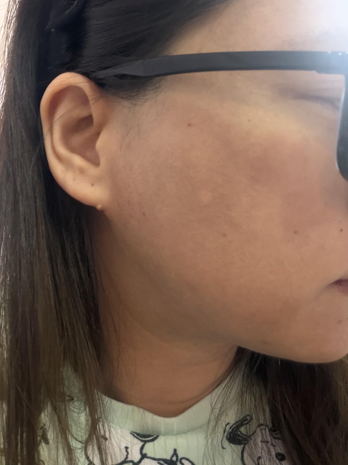 medicube Mini Booster Pro Plus - Portable Facial Device for Radiance, Pink | Facial Device for Radiance, Calming, and Elasticity - Red, Blue, Purple 3-Mode, Korean Skincare Device, At Home Care, Pink customer photo 2