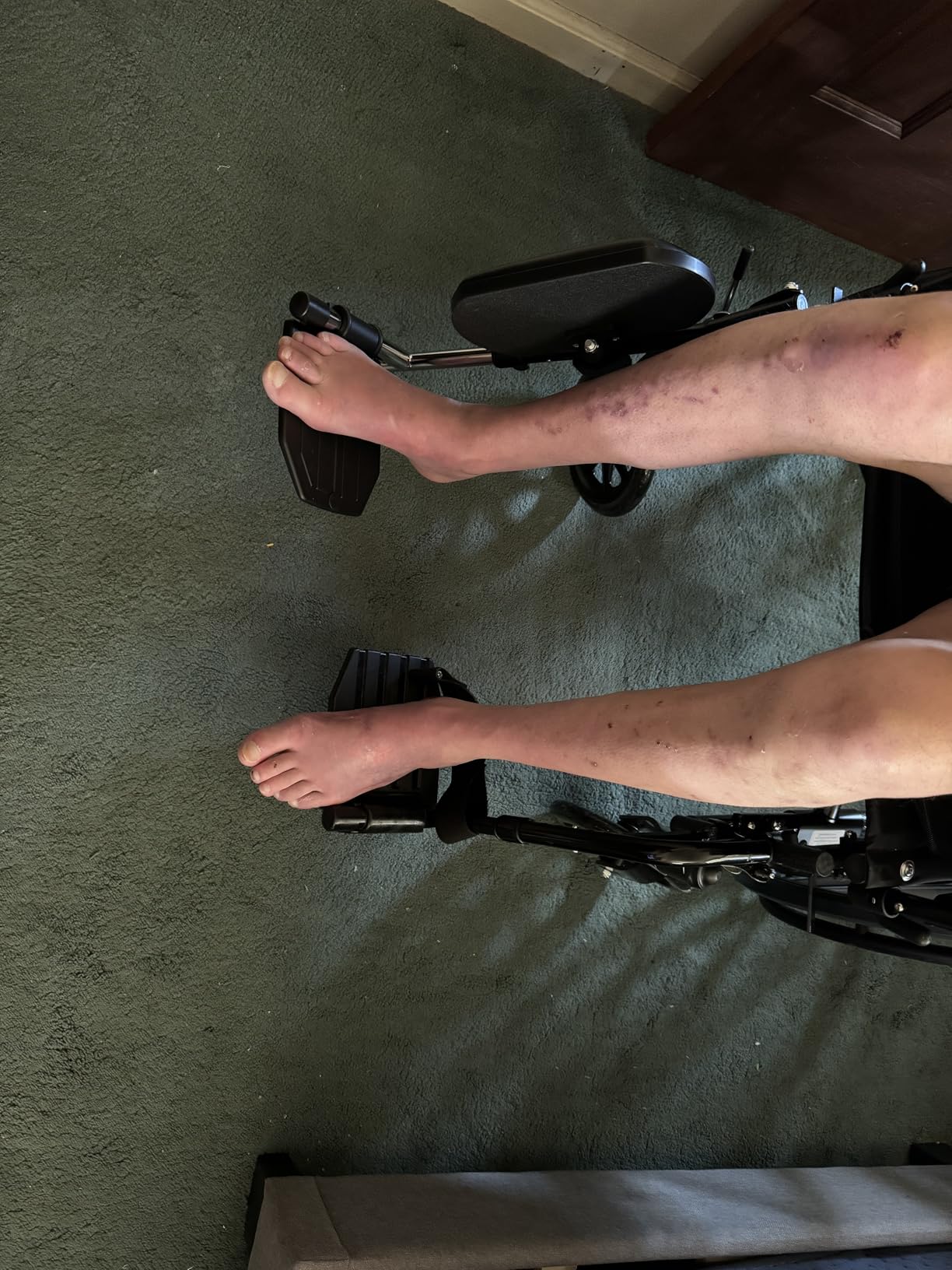 Invacare Wheelchair Elevating Legrest with Padded Calf Support, Footrest with Swing Away Function, Adjustable Length and Aluminum Footplate, Tool-Free Installation, Designed for Invacare Wheelchair customer photo 2