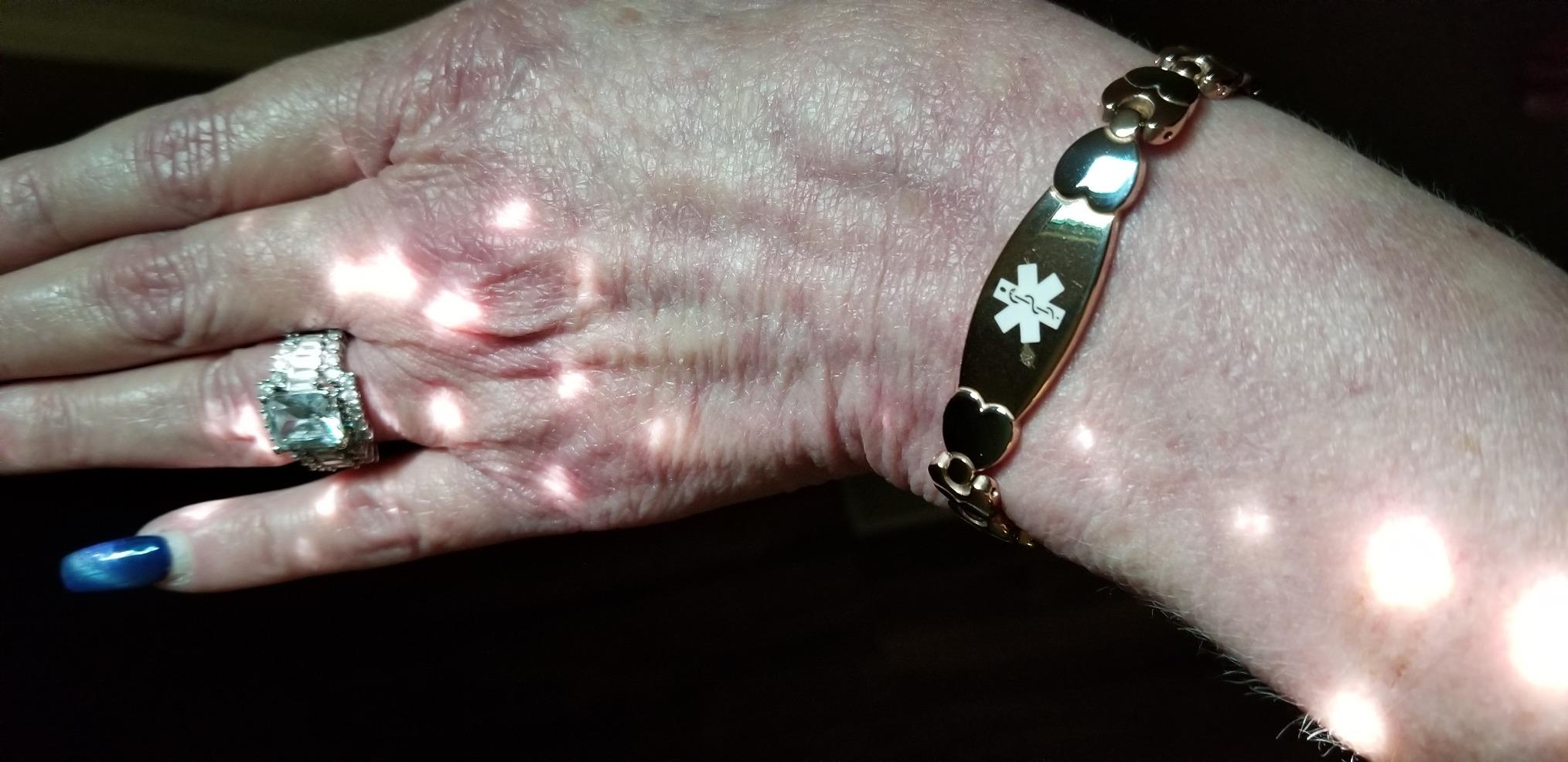 Heart Medical Alert id Bracelets for Women with Customize Engraving Medical Condition-Blood thinner,Lymphedema, Allergies and More customer photo 1