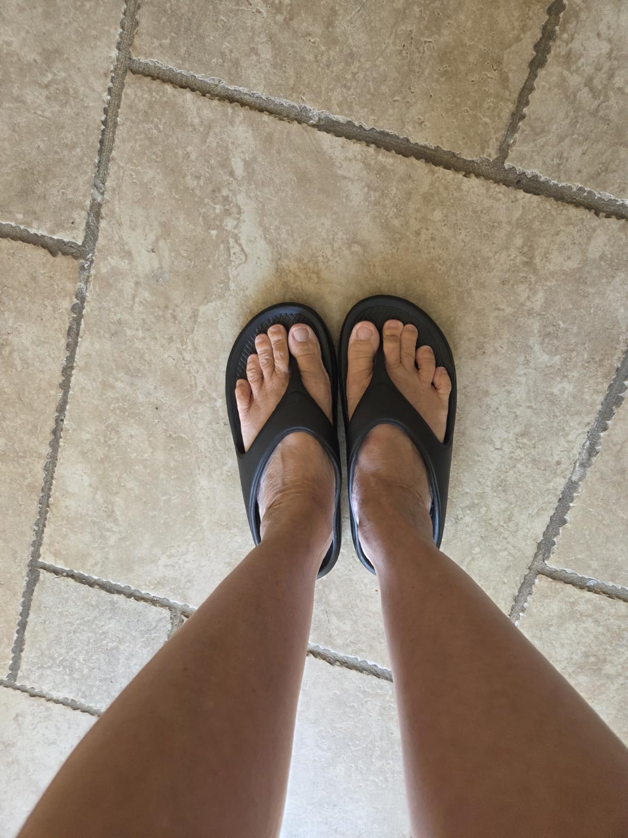 shevalues Orthopedic Sandals for Women, Arch Support Recovery Flip Flops | Orthotic Pillow Soft Summer Beach Shoes, Comfortable for Plantar Fasciitis customer photo 1