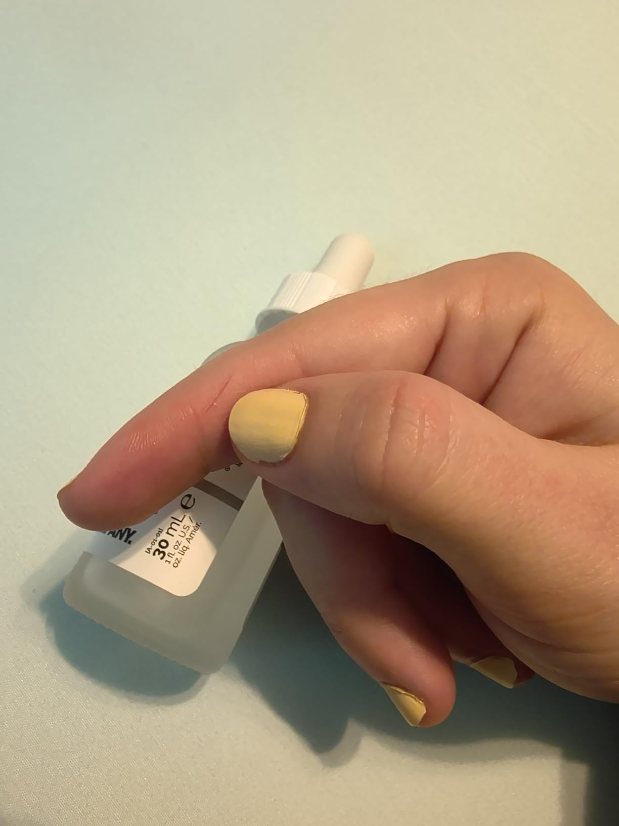 The Ordinary Niacinamide 10% + Zinc 1%, Smoothing Serum for Blemish-Prone Skin customer photo 2