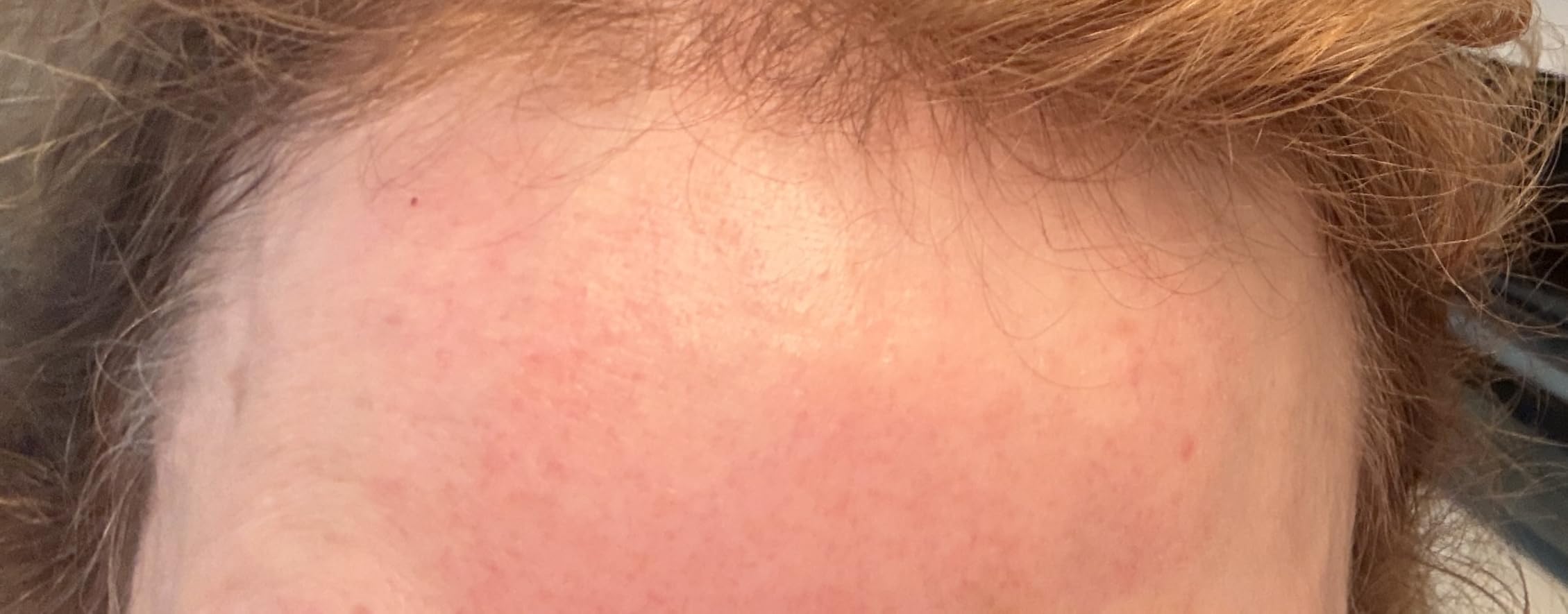 The Ordinary Hyaluronic Acid 2% + B5 (with Ceramides), Multi-Depth Hydration Serum for Plumper, Smoother Skin customer photo 2